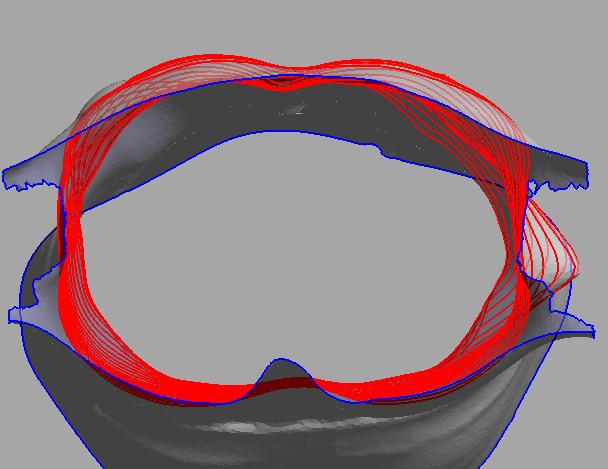 Image:UniSA-bound5.jpg