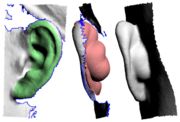 Fig 5. Offset Surface