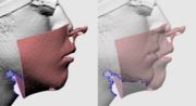 Fig 2. Mesh Opacity